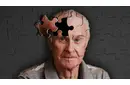 Alzheimer Kaç Yaşında Başlar?